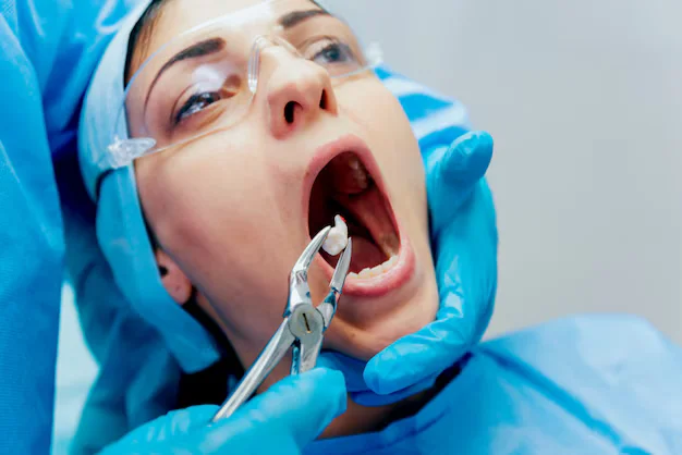 Wisdom teeth surgery at Novel Dental